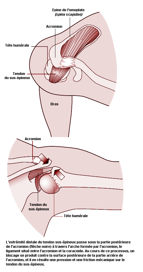 Figure 6.18