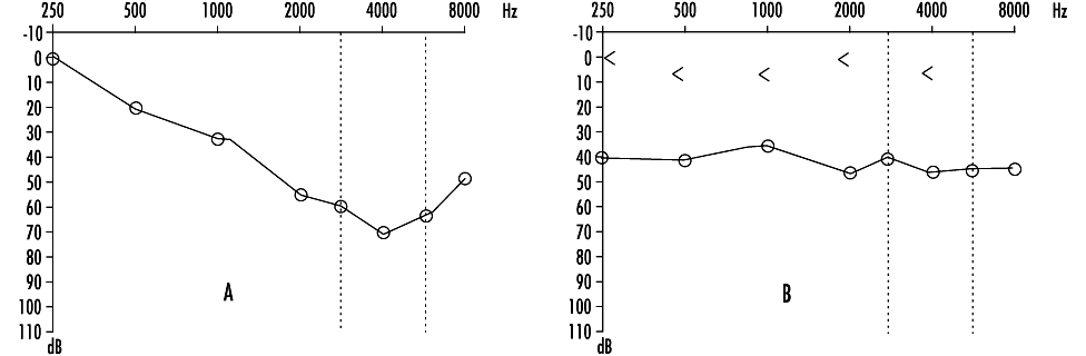 Figure 11.4